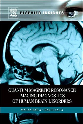Functional Magnetic Resonance Imaging: 9780878936274: Medicine