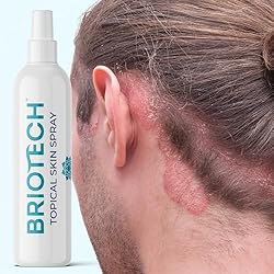 BRIOTECH Topical Skin Spray, Pure Hypochlorous Acid