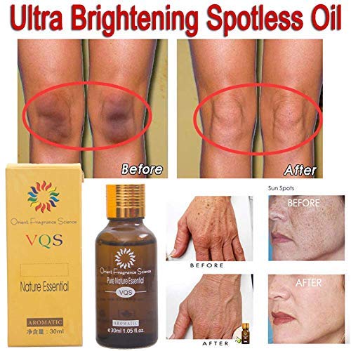 Ultra Brightening Spotless Oil Dark Spots Removal Age Spots Hyper-Pigmentation(2PCS)