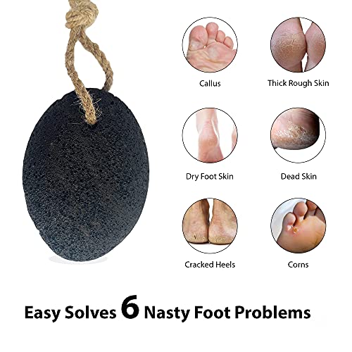 Foot Pumice Stone by VNI Stone Natural Earth Lava Pumice Stone for Feet callus removal Callus