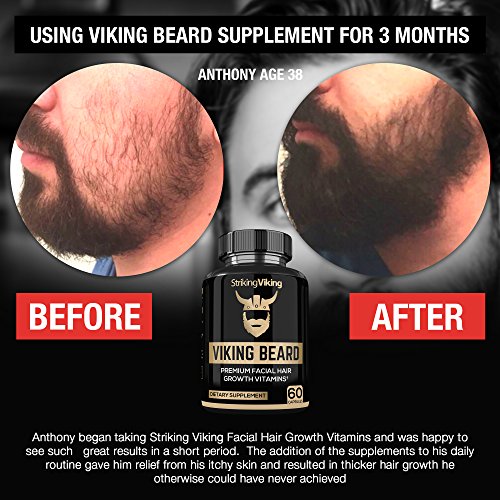 Beard Growth Supplements For Mens Hair Natural Dht Blockers