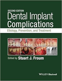 Dental Implant Complications: Etiology, Prevention, and Treatment Dental Implant Complications: Etiology, Prevention, and Treatment