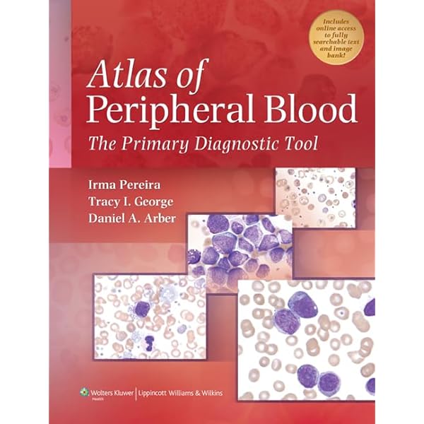 The AST Handbook of Transplant Infections: Kumar, Deepali