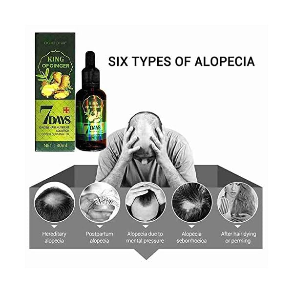 Hair Growth Serum, Hair Care Product, Hair Serum, Fast Hair Growth, Hair Growth & Hair Thickening,Stop Hair Loss, Grow…