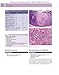 Dermatopathology: Expert Consult - Online and Print