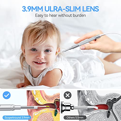 ScopeAround Otoscope Ear Camera with 4.5" IPS Screen, 1920x1080 FHD