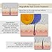 MagnaRoller Scalp Massager for Hair Growth - Hair Loss Treatment for Men and Women with Thinning, Dry and Dull Hair - Increases Blood Flow to Scalp & Hair follicles for Thicker, Healthier Hair.