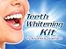 Teeth Whitening Kit by Advanta Supplements - Extra Strong, for Home Use - Includes 2 Moldable Trays, 2 Gel Syringes, and 1 Whitening Pen