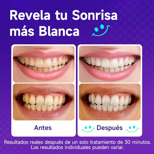Teethbliss Tiras Blanqueadoras Dientes Moradas: Blanqueador Dental Morado, 7 Tratamiento Efecto Rápido Eliminar Café, Vino, Tabaco Manchas, Seguro Esmalte, Blanqueamiento para Bodas, Citas Trabajar
