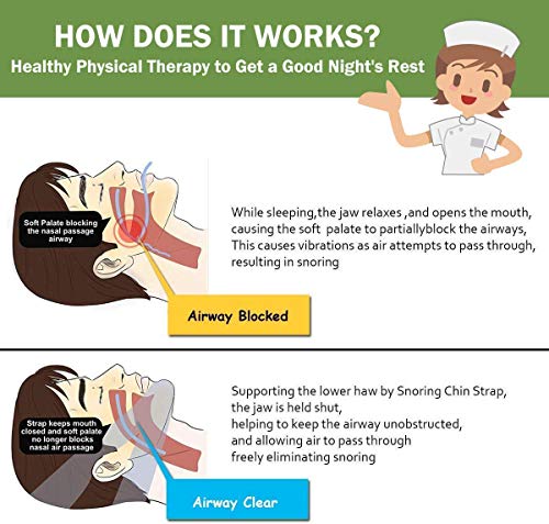 Anti Snoring Chin Strap,Adjustable Snoring Chin Strap for Men and Women,Stop Snoring Chin Strap Solution and Effective Sleep Aids Snore Chin Strap, Anti Snoring Devices