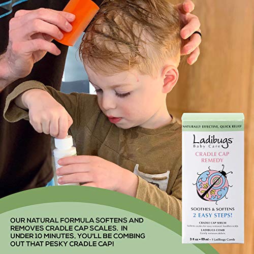 Ladibugs Cradle Cap Remedy Kit, 3oz Includes Cradle Cap Serum & Fine