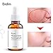 Endim Titanium Microneedle Derma Roller 540 Micro Needles Skin Care Needle 0.25mm+hyaluronic acid serum-EOE