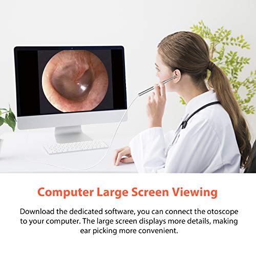 3 Otoscope+Upgraded+Endoscope+Removal+Android