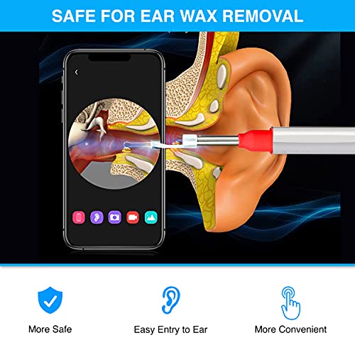 Ear Wax Removal Otoscope Wireless with Free Container and Ear Pick Set