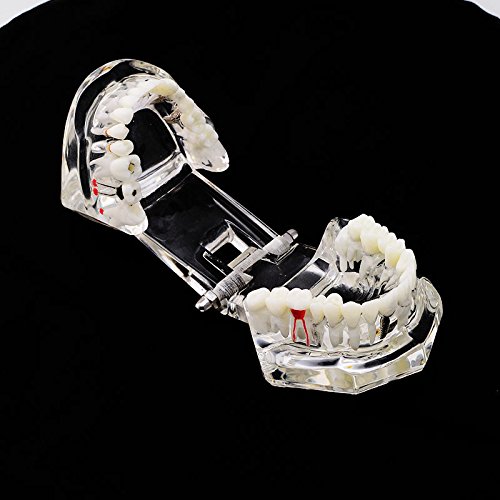 3 Dental+Teaching+Typodont+Removable+ZJ+COSM
