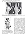 Pediatric Endocrinology: Expert Consult - Online and Print (Sperling, Pediatric Endocrinology)