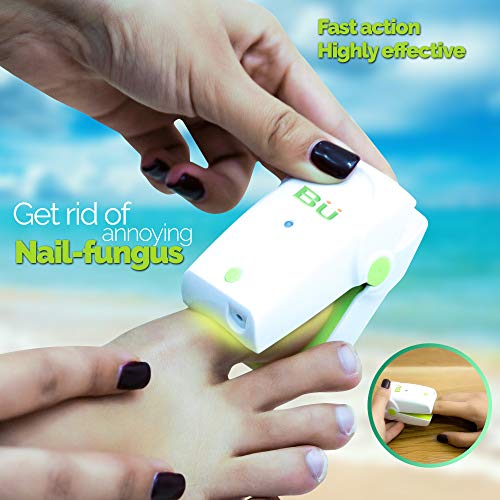 Nail Laser Toenail Treatment Revolutionary and Safe Treatment for Toe