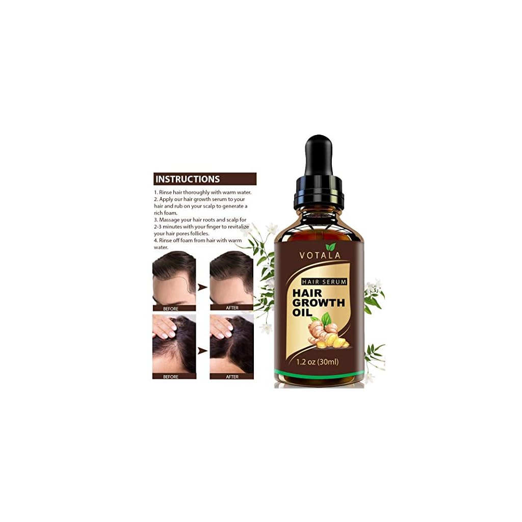 Hair Growth Serum, VOTALA Hair Growth Treatment, Anti Hair Loss