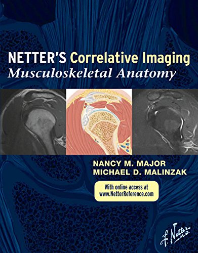 Netter Correlative Imaging: Musculoskeletal Anatomy E-book: with Online Access at www.NetterReference.com (Netter Clinical Science)