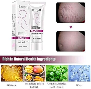 rtopr stretch mark cream