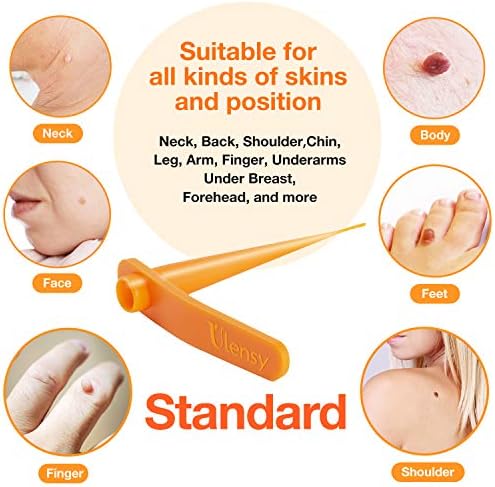 skin tag removal cost