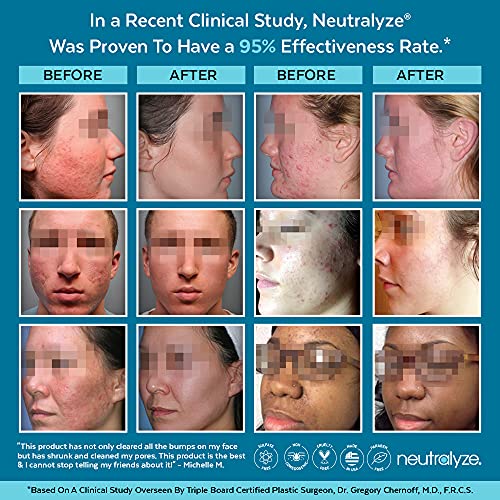 Neutralyze Acne Face Wash Medical Grade 2 Mandelic Acid & Salicylic