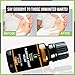 Plantar Warts Relief, All Natural Wart Remover Essential Oil Blend Fast-Acting Common and Plantar Warts Treatment by wonder healing (10 ml)thumb 3