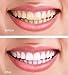 Shoreline Cosmetics Simple Teeth Whitening Foam