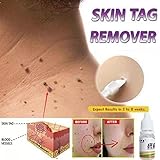 Meflying Strength Skin Tag Remover Foot Treatment Mole Skin Tag Body Warts Remover Skin Care Tools