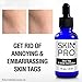 SkinPro Skin Tag Remover & Mole Corrector | Medical Grade Formula with 17% Salicylic Acid | Rapid Excess Skin Removal | Extra Strength Solutionthumb 2
