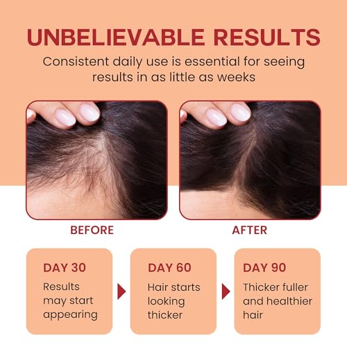 LBOYLOVE® Raw Batana Oil for Hair Growth - 100% Pure, Organic 4oz Batana from Honduras for Thick and Strong Natural Hair - Dr. Sebi Unrefined Cold Pressed Cosmetic Scalp Mask Gifts for Women