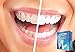 WhiteLabs Professional At Home Teeth Whitening Kit- DDS Approved – Easy to Use – Fast Results –