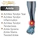 TherMedic Far Infrared Heating Brace with Heating/Thermal Pad and Ice Pack for Slap Tear, Labral Tear and Frozen Ankle, Ankle pain (PW170)