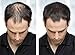 ESPIRITU DE CANELA CINNAMON SPIRIT OIL MEN WOMEN HAIR LOSS BALDING REGROWTH TREATMENT by Pharmark