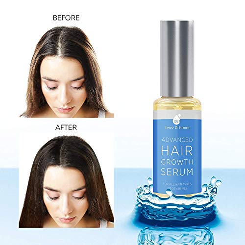 Hair Growth Serum for Thicker Longer Fuller Healthier Hair, Help hair follicle growth,Prevent Hair Loss & Thinning, With Natural Vitamin Rich Treatment, All Hair Types