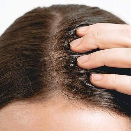 ordinary hair serum amazon