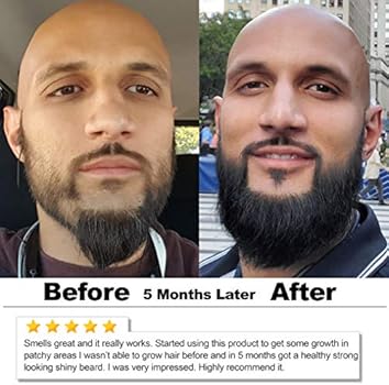 Okay Men S Castor Oil Beard Hair Growth Oil 4 Fluid Ounce Brown 4 Fluid Ounce Buy Online At Best Price In Uae Amazon Ae