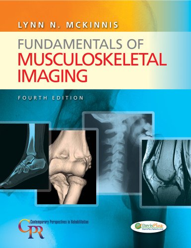 Download Fundamentals of Musculoskeletal Imaging (Contemporary Perspectives in Rehabilitation) Download Fundamentals of Musculoskeletal Imaging (Contemporary Perspectives in Rehabilitation)