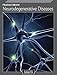 Fragile Brain: Neurodegenerative Diseases
