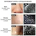 Skymore Blackhead Remover Mask, Purifying Peel-Off Facial Mask for Blackhead Removal, Acne Treatment, Oil Control, Deep Cleansing Nose Black Mud Mask 60g
