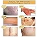 TCM Scar Cream, LanBeNa Acne Scar Removal Cream, Scar Skin Repair Face Cream Acne Spots Acne Treatment Blackhead Whitening Cream Stretch Marks 30ml