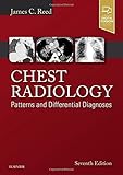 Chest Radiology: Patterns and Differential Diagnoses