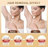SZSZLMY 3-in-1 IPL Laser Hair Removal, 9-Level Adjustable Ice-Cold view 2