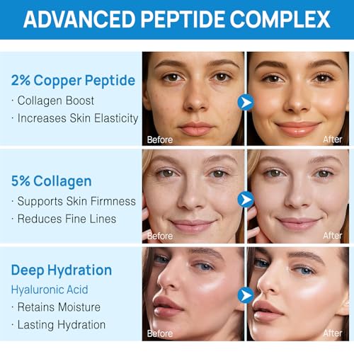 Copper Peptides Ghk-cu Serum, Ghk-cu Peptide Serum, Copper Peptide Serum for Tightening, Collagen Boosting & Hydrat, Reduces Fine Lines and Wrinkles (2PC, 60ML)