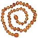 Baltic Amber Teething Necklace for Babies - Raw not polished Amber - Maximum Pain Relief - Safety Knotted - Best quality for best price ! (11.8 inches, Orange)