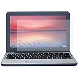 CaseBuy ASUS Chromebook 11.6 Inch Ultra Clear Glossy Screen Protector Cover Skin for ASUS C200 C200MA C201 C202SA 11.6