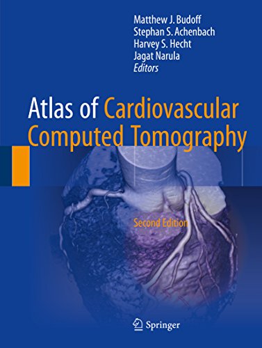 [D.o.w.n.l.o.a.d] Atlas of Cardiovascular Computed Tomography<br />[T.X.T]