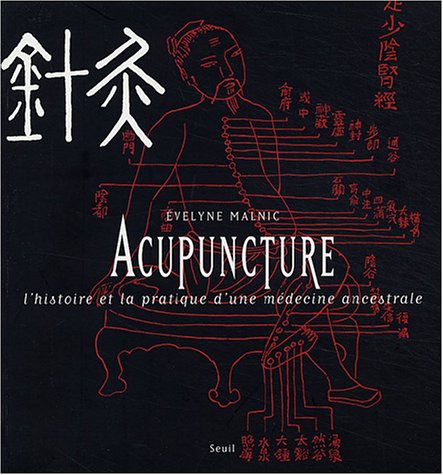 Acupuncture