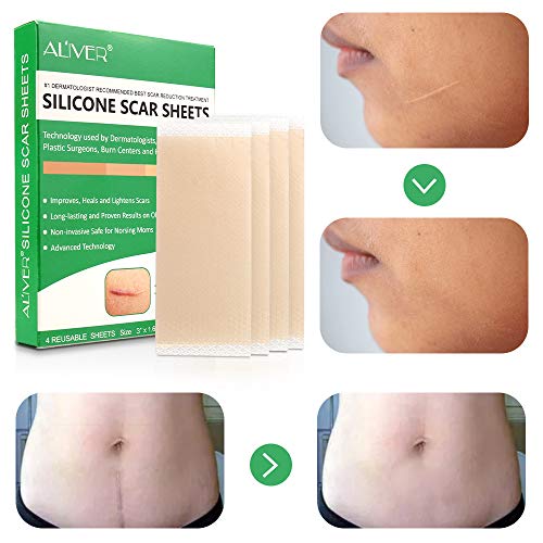 Reusable Silicone Scar Removal Sheets,Professional for Scars Caused by