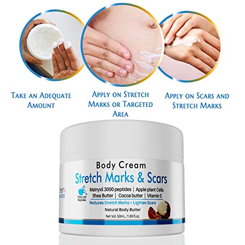 body stretch mark cream